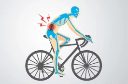 ¿Es bueno hacer bicicleta para el nervio ciático?